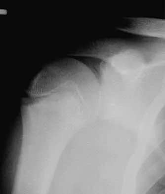 Trauma 2026 MCQs: Board Review Questions & Answers (Part 2) - Figure 49