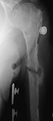 Trauma 2026 MCQs: Board Review Questions & Answers (Part 2) - Figure 59