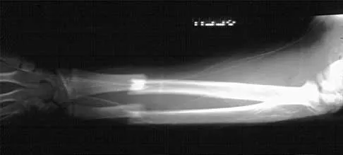 Trauma 2026 MCQs: Board Review Questions & Answers (Part 2) - Figure 7