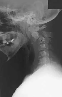 Trauma 2026 MCQs: Board Review Questions & Answers (Part 2) - Figure 85
