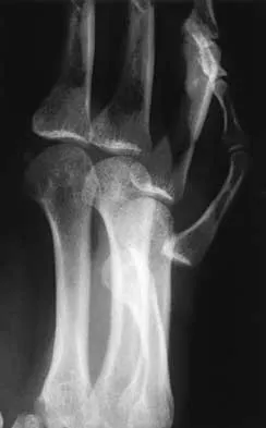 Trauma 2026 MCQs: Board Review Questions & Answers (Part 2) - Figure 89