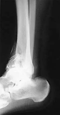 Trauma 2026 MCQs: Board Review Questions & Answers (Part 3) - Figure 11