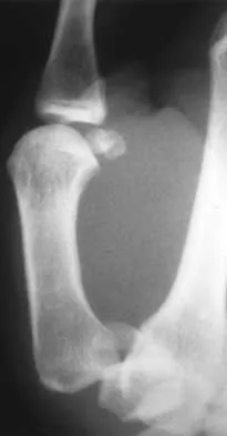 Trauma 2026 MCQs: Board Review Questions & Answers (Part 3) - Figure 25