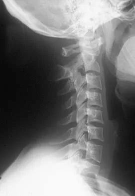 Trauma 2026 MCQs: Board Review Questions & Answers (Part 3) - Figure 43