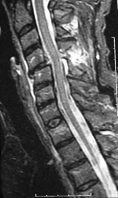 Trauma 2026 MCQs: Board Review Questions & Answers (Part 3) - Figure 49