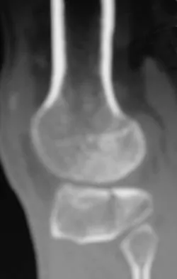 Trauma 2026 MCQs: Board Review Questions & Answers (Part 3) - Figure 79