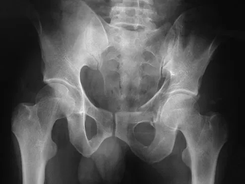 Trauma 2026 MCQs: Board Review Questions & Answers (Part 3) - Figure 81