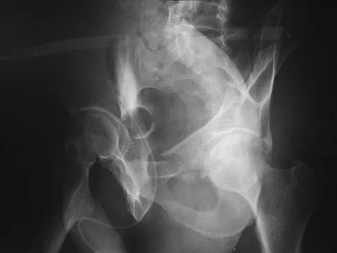 Trauma 2026 MCQs: Board Review Questions & Answers (Part 3) - Figure 83