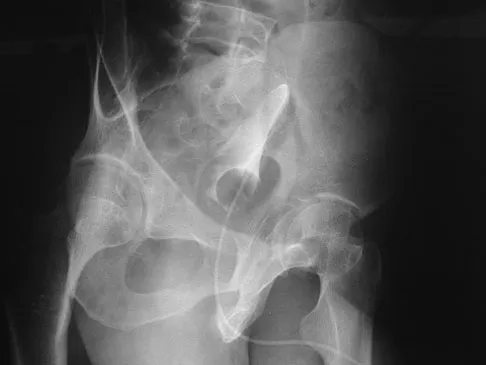 Trauma 2026 MCQs: Board Review Questions & Answers (Part 3) - Figure 85