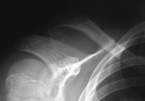 Trauma 2026 MCQs: Board Review Questions & Answers (Part 3) - Figure 91