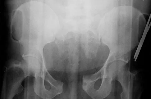 Trauma 2026 MCQs: Board Review Questions & Answers (Part 3) - Figure 95