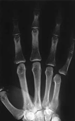 Trauma 2026 MCQs: Board Review Questions & Answers (Part 4) - Figure 15