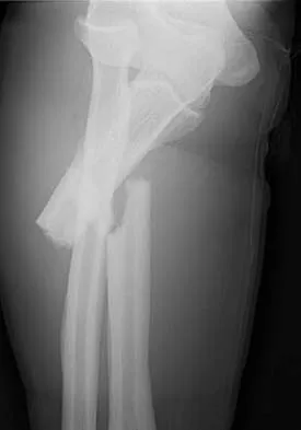 Trauma 2026 MCQs: Board Review Questions & Answers (Part 4) - Figure 45