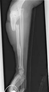 Trauma 2026 MCQs: Board Review Questions & Answers (Part 4) - Figure 47