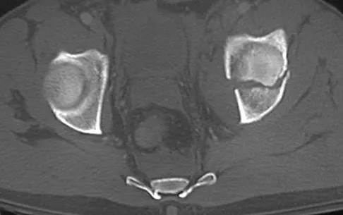 Trauma 2026 MCQs: Board Review Questions & Answers (Part 4) - Figure 59