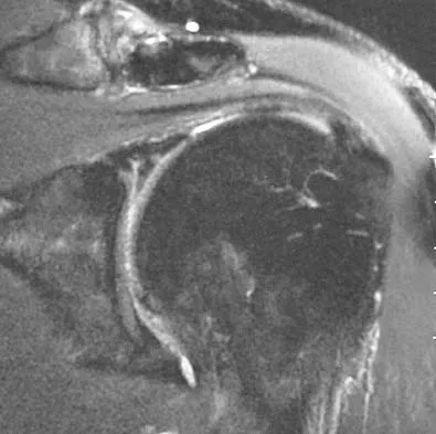 Upper Extremity 2005 Practice Questions: Set 1 (Solved) - Figure 12
