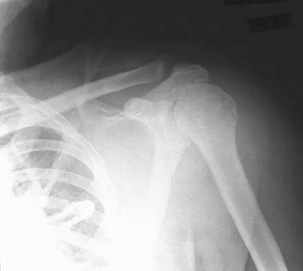 Upper Extremity 2005 Practice Questions: Set 1 (Solved) - Figure 16