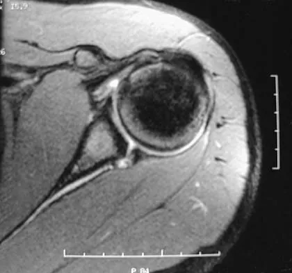Upper Extremity 2005 Practice Questions: Set 1 (Solved) - Figure 23