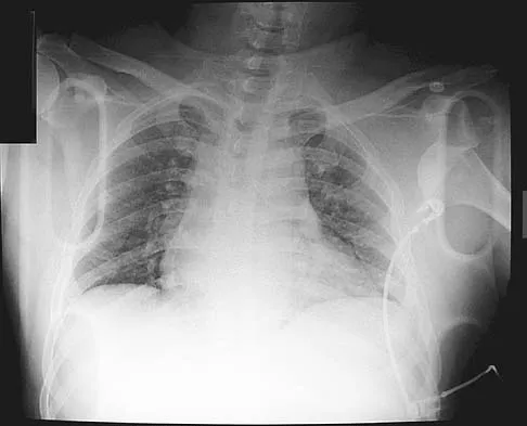 Upper Extremity 2005 Practice Questions: Set 1 (Solved) - Figure 7