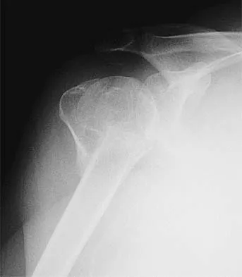 Upper Extremity Board Review 2005: High-Yield MCQs (Set 2) - Figure 12