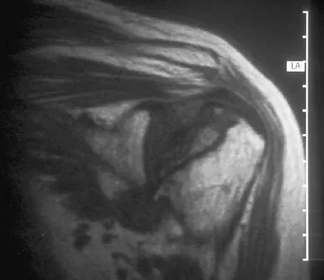 Upper Extremity Board Review 2005: High-Yield MCQs (Set 2) - Figure 22
