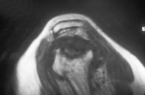 Upper Extremity Board Review 2005: High-Yield MCQs (Set 2) - Figure 23