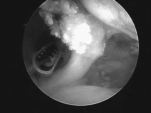 Upper Extremity Board Review 2005: High-Yield MCQs (Set 2) - Figure 8