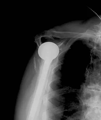 Upper Extremity 2005 Practice Questions: Set 3 (Solved) - Figure 12