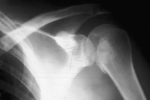 Upper Extremity 2005 Practice Questions: Set 3 (Solved) - Figure 6