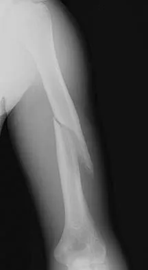 Upper Extremity Board Review 2005: High-Yield MCQs (Set 4) - Figure 13