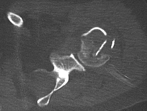 Upper Extremity Board Review 2005: High-Yield MCQs (Set 4) - Figure 2