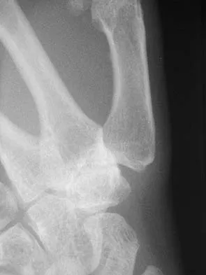 Upper Extremity 2005 Practice Questions: Set 5 (Solved) - Figure 15