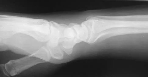 Upper Extremity 2005 Practice Questions: Set 5 (Solved) - Figure 3