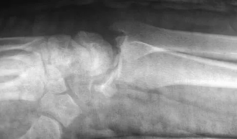 Upper Extremity 2005 Practice Questions: Set 5 (Solved) - Figure 9