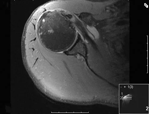 Upper Extremity 2008 Practice Questions: Set 1 (Solved) - Figure 10