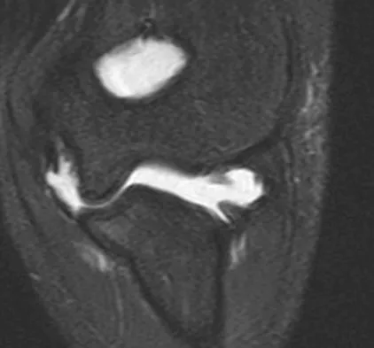 Upper Extremity 2008 Practice Questions: Set 1 (Solved) - Figure 12