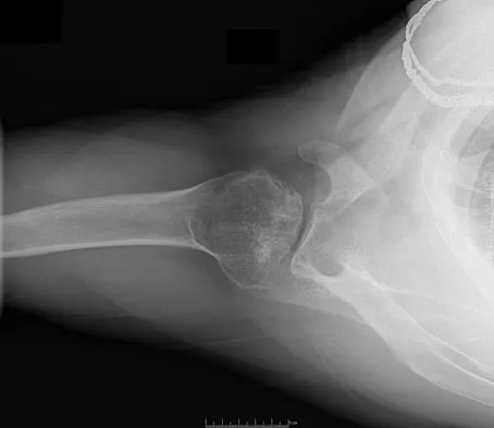 Upper Extremity 2008 Practice Questions: Set 1 (Solved) - Figure 22