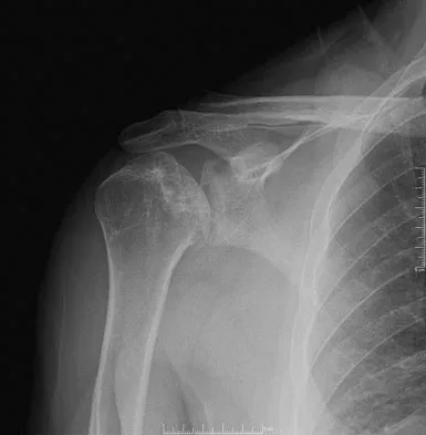 Upper Extremity 2008 Practice Questions: Set 1 (Solved) - Figure 23
