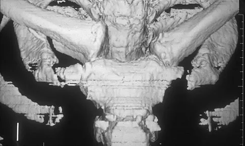 Upper Extremity 2008 Practice Questions: Set 1 (Solved) - Figure 26