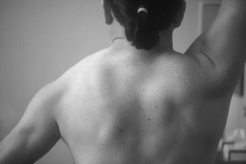 Upper Extremity 2008 Practice Questions: Set 1 (Solved) - Figure 28