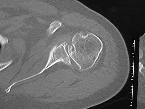Upper Extremity 2008 Practice Questions: Set 1 (Solved) - Figure 3