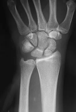 Upper Extremity 2008 Practice Questions: Set 1 (Solved) - Figure 30