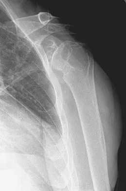 Upper Extremity 2008 Practice Questions: Set 1 (Solved) - Figure 31