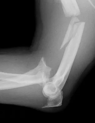 Upper Extremity 2008 Practice Questions: Set 1 (Solved) - Figure 34