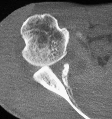 Upper Extremity 2008 Practice Questions: Set 1 (Solved) - Figure 5