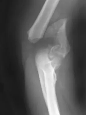 Upper Extremity 2008 Practice Questions: Set 1 (Solved) - Figure 7