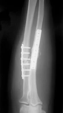 Upper Extremity Board Review 2008: High-Yield MCQs (Set 2) - Figure 10