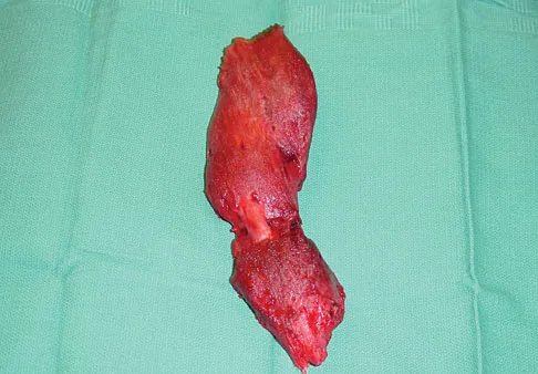 Upper Extremity Board Review 2008: High-Yield MCQs (Set 2) - Figure 13