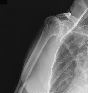 Upper Extremity Board Review 2008: High-Yield MCQs (Set 2) - Figure 18