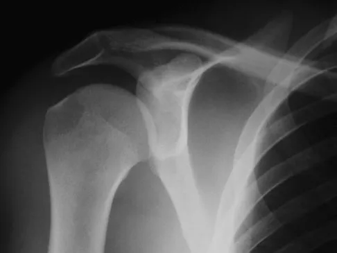 Upper Extremity Board Review 2008: High-Yield MCQs (Set 2) - Figure 19
